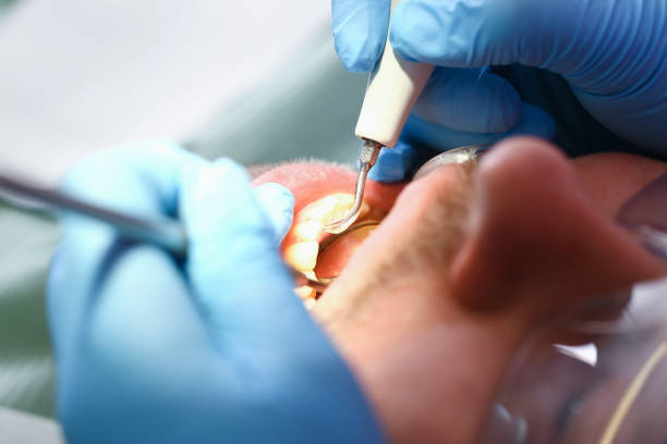 Best Mobile Emergency Dentist in West Canton, NC