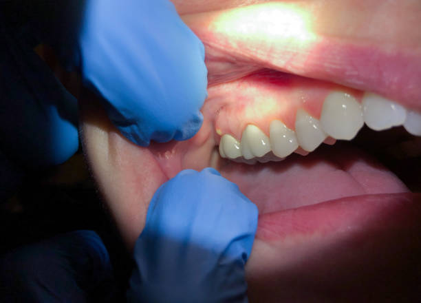 Best Urgent Dental Care for Toothache in West Canton, NC