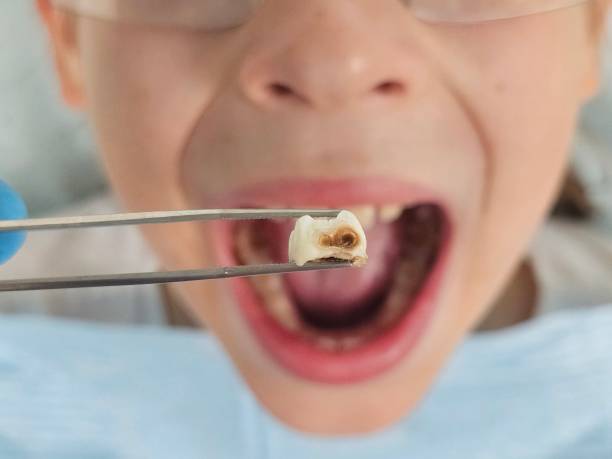 Best Emergency Dentist for Special Needs Patients in West Canton, NC
